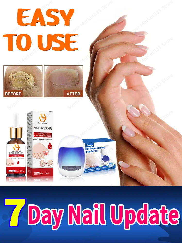 

Laser Product For Solving Nail Problems