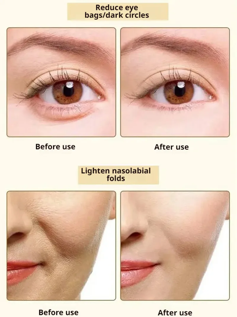 Collagen Patch Sample Watersoluble Patch Type III Forehead Patch Sample Bare Pockets Decline Patch