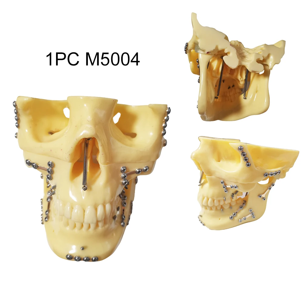 

Dental Skull Model M5004 Dentistry Medicine Skull Fracture Fixation Model For Teaching Student Practice Head Model Dentistry