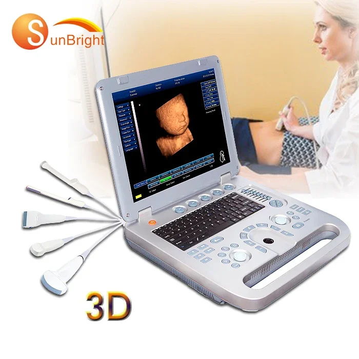 Sun-800D Low cost laptop hospital 3D OB GYN ultrasound machine with high quality