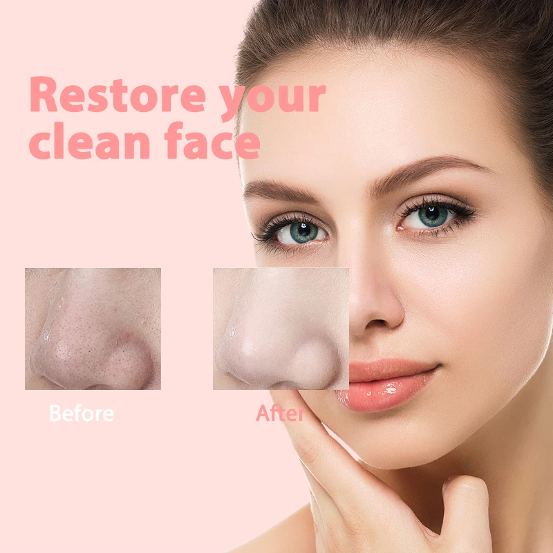 Em estoque transporte da gota rápida 3 modo de sucção máquina de beleza de limpeza facial removedor de pele morta rosto vácuo remoção cravo pele