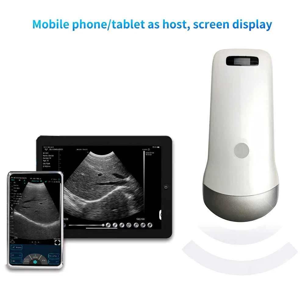 80 Elements Wireless Probe Type Ultrasound Scanner Frequency 3.5Mhz B&W Abdomen Ultrasound Basic Convex Probe