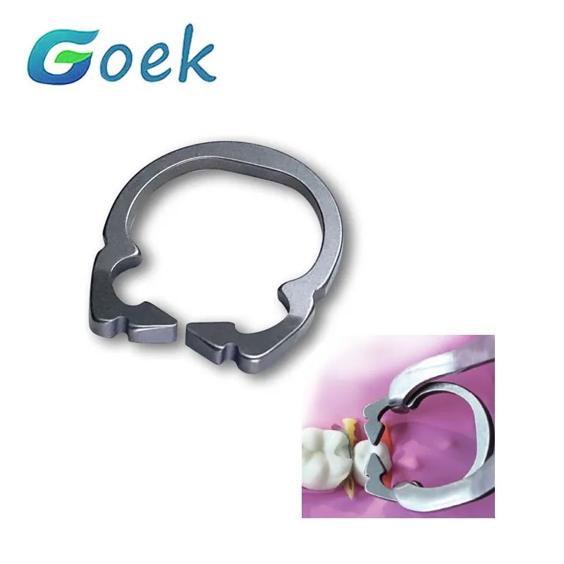 

1pc Dental Clamp Ring R1 2.0 Standard Nickle-titanium With Functions of Separating and Retianing Orthodontic Materials