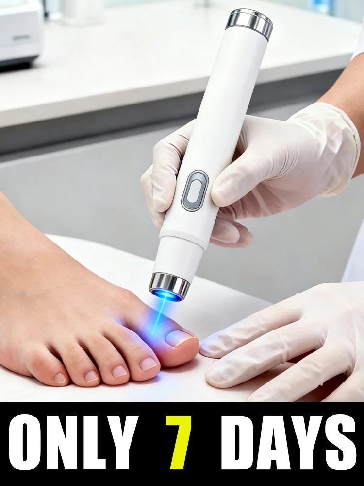 

Nail Care Laser Pen, Homeopathic Treatment for Onychomycosis