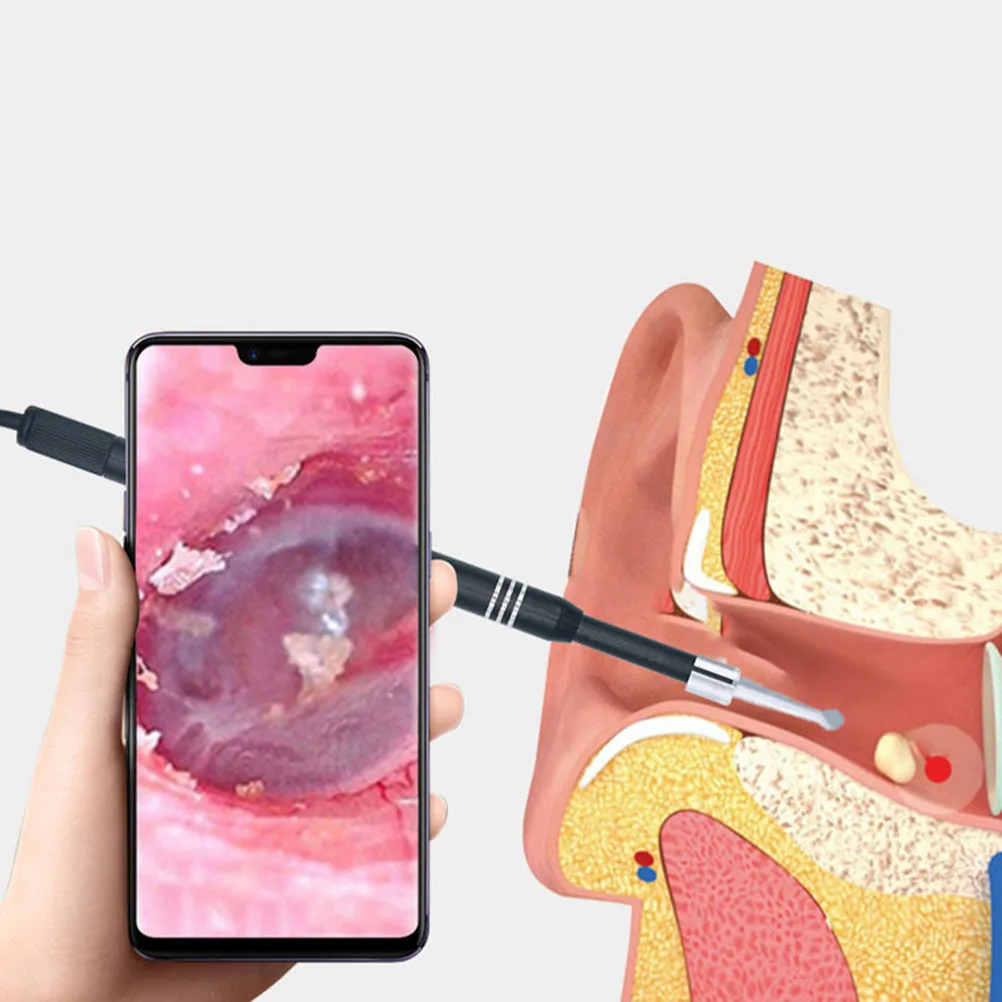 

5.5mm Visual Otoscope Digital Hd Display Camera for Earwax Removal and Ear Inspection Digital Otoscope