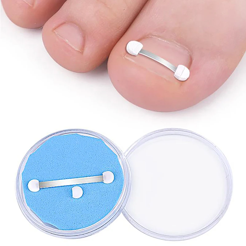 1PC Front Nail Hook Band Nail Ingrown Toe Nail Correction Toenail Nail Ingrown Clip Orthosis Paronychia Tools