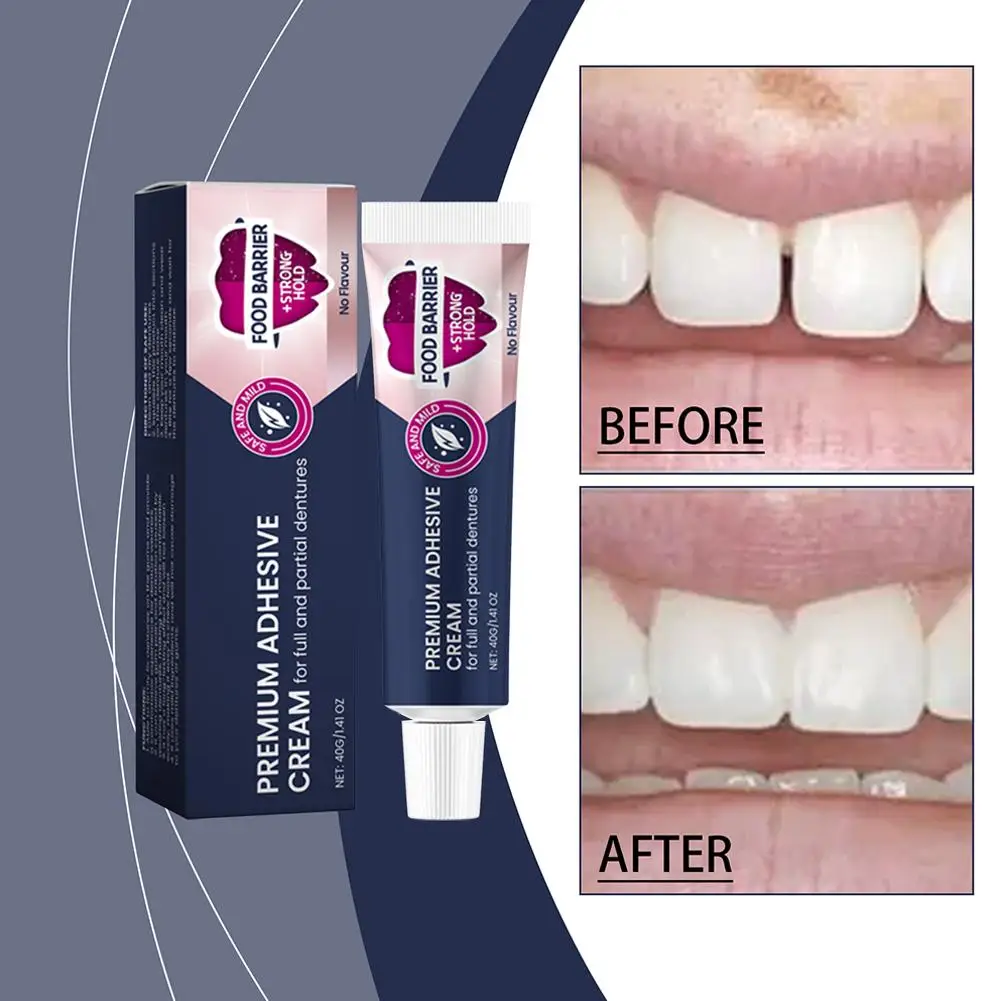 40g Fixodent Dental Kleber Creme Für Prothese Original Starke Komplette Professionelle Zahnersatz Kleber Zahnmedizin Produkte Mater Z3I3