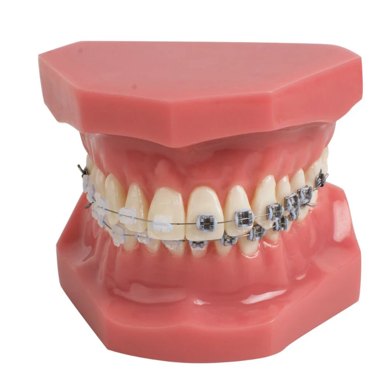 

Orthodontic model Half ceramic half metal bracket dental model