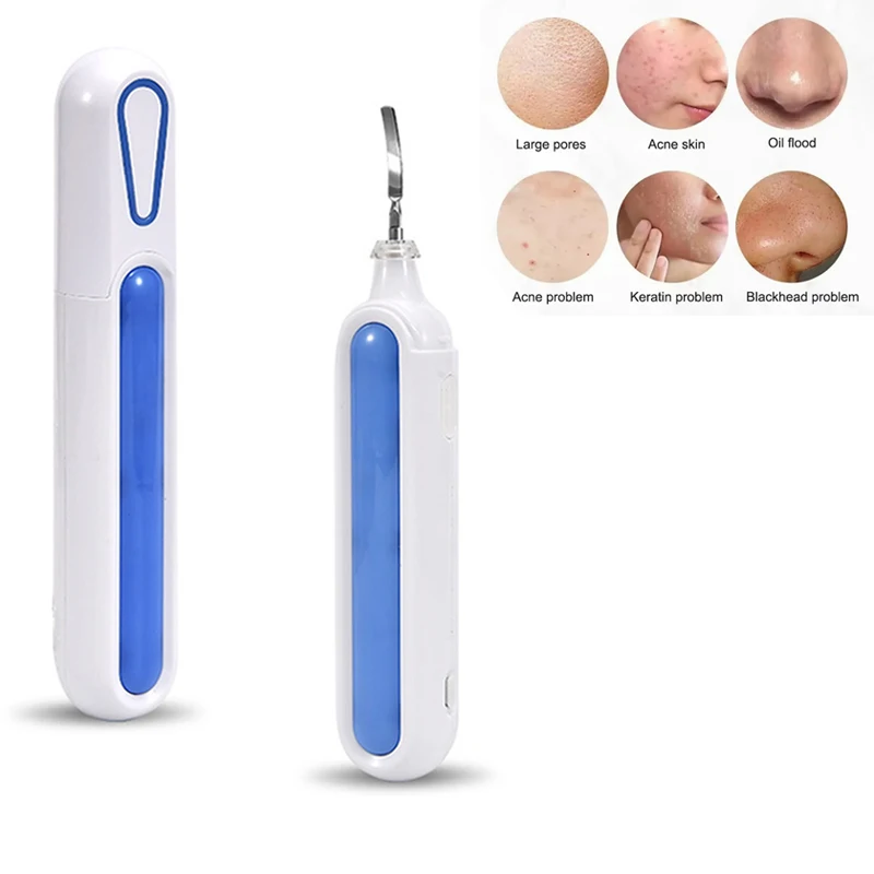 초음파 피부 스크러버 필링 블랙헤드 제거기 딥 페이스 클리닝 초음파 이온 여드름 모공 클리너 페이셜 스크러버