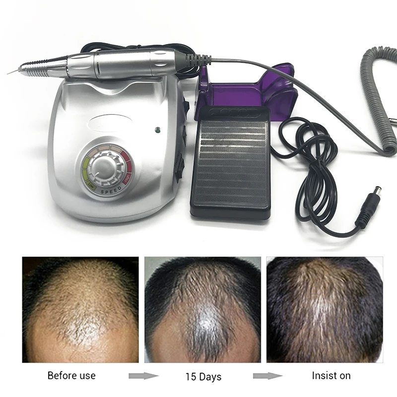 

Hair Follicle Transplantation Equipment Hair Grown Transplant Implanter FUE Beauty Tools Hairline Eyebrows Hair Regrowth