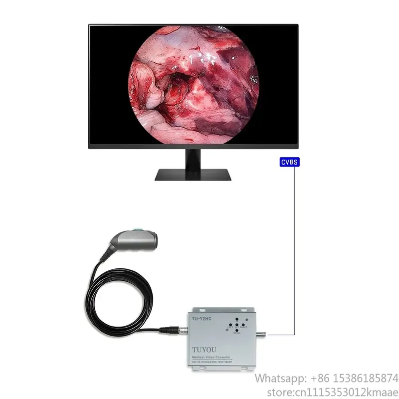 HD USB Endoscope Camera for Laptop – Medical Endoscopy Camera with Handle