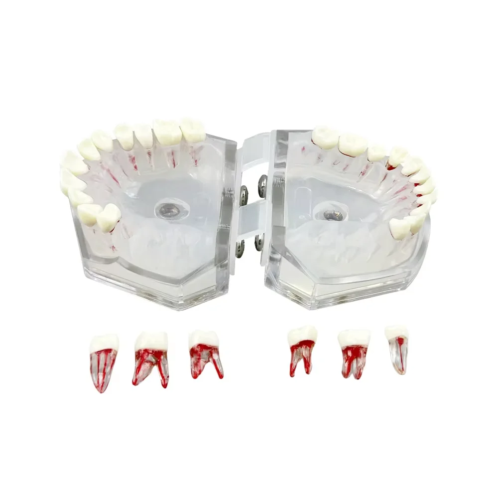 Endodontic Teeth Model For Training Practice Tooth Extraction Model Dental Standard Model With Removable Root Canal Typodont New