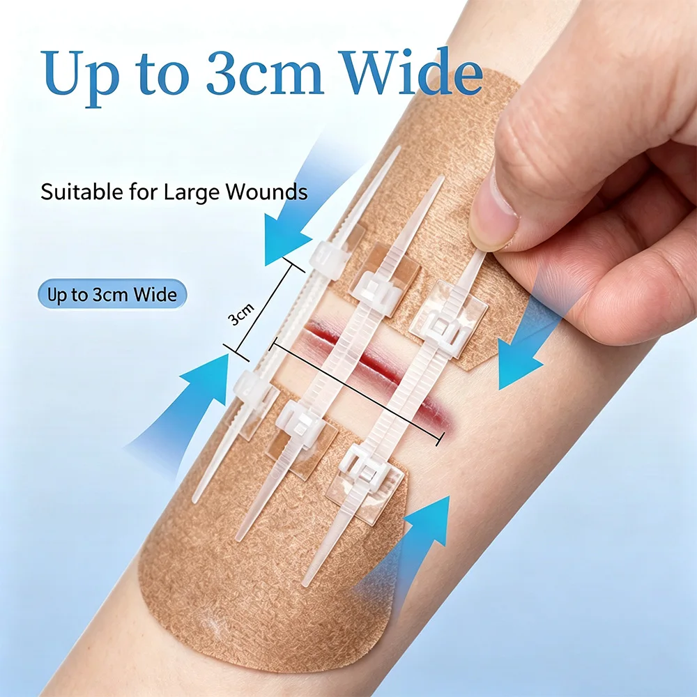 Pull-Tab Wound Tension Reducer, Large Size Skin Tension Reduction Patch, Non-Invasive Wound Closure, Postoperative Wound Tension Care, Home First Aid Trauma Dressing (Double Buckle/Three Buckle)