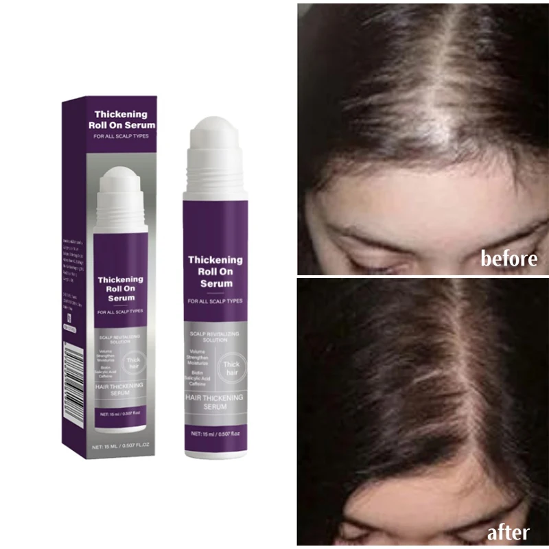 

Hair Growth Roll-on Essence Thick Repair Strengthen Shiny Hair Nourish Scalp Oil-removing And Moisturizing Hair Hair Care Serum