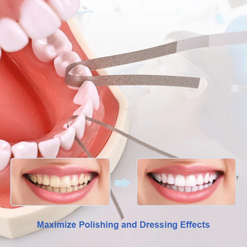 

SYJH 40Pcs Dental Polishing Strips For Interproximal Application Finishing And Polishing Polish Strip Dental Lab Materials