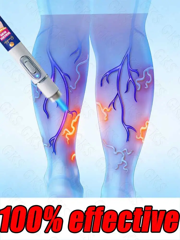 

Последняя модель: восстановление здоровья ног