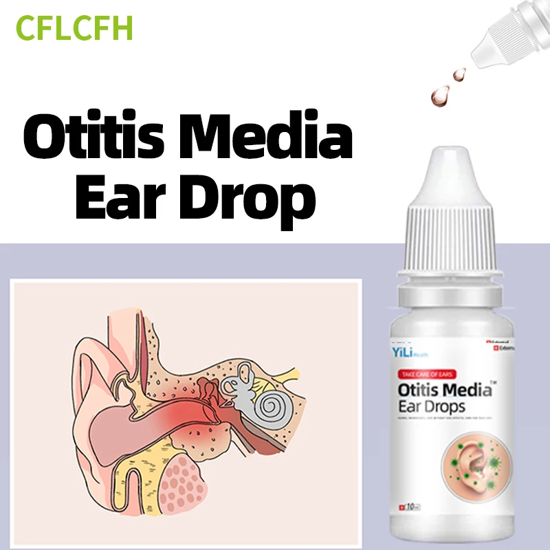 

Otitis Media Ear Drop Medicine For Acute Otitis Cure Ear Wax Remover Cleaner Drops 10Ml Ear Pain Bacterial Infection Itching