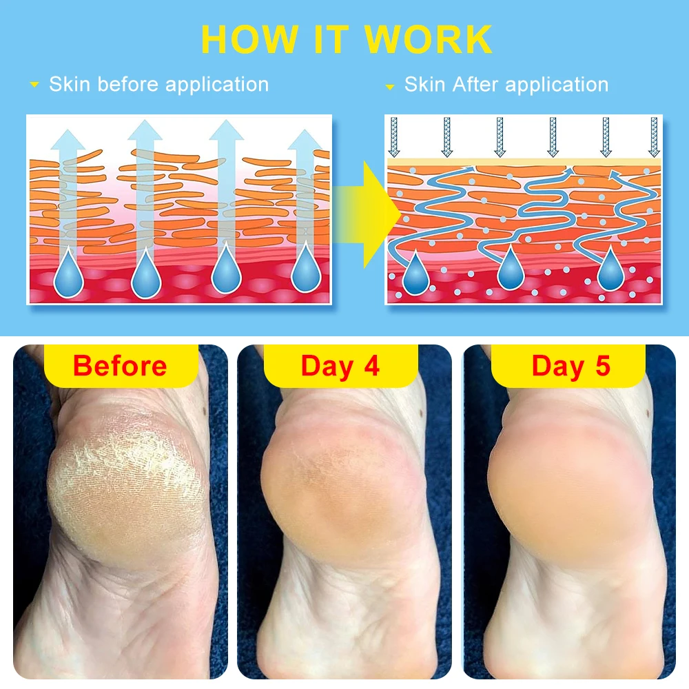 Beauty Product Herbal Anti Crack Foot Cream Heel Cracking Repair Products Exfoliation Dead Skin Removal Softening Moisturize