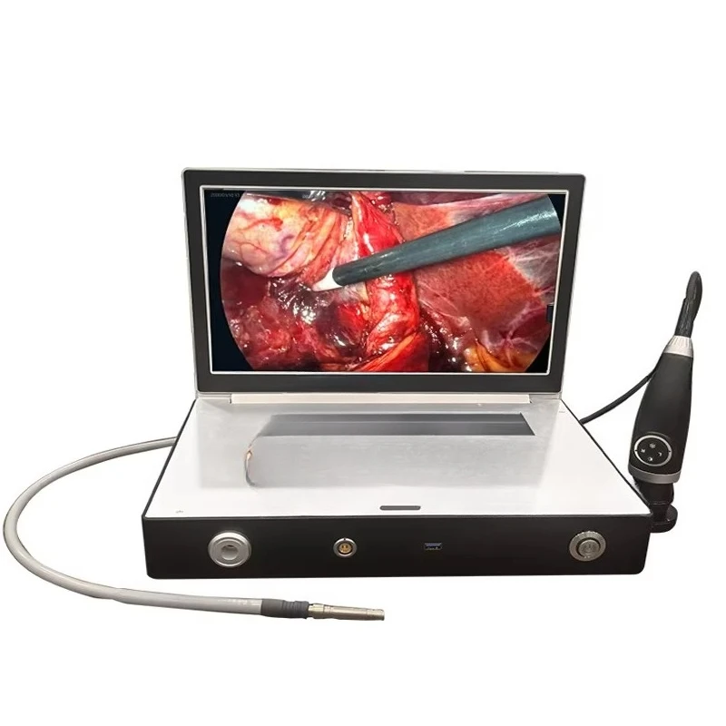 Portable laptop-based endoscopic  system, full high definition 1080P, suitable for otolaryngology and veterinary surgeries