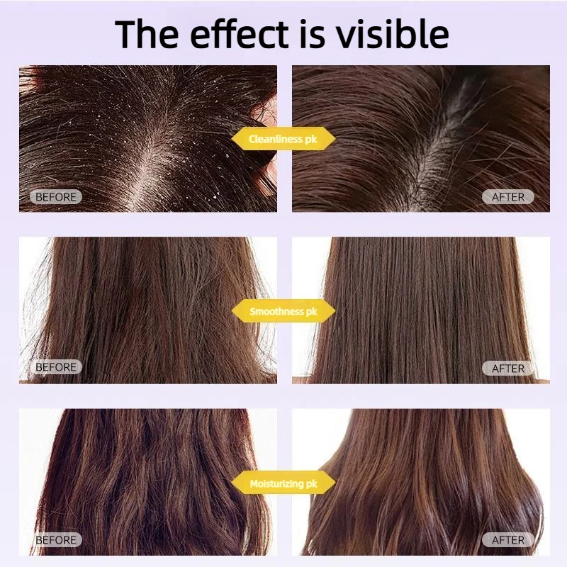 

Массажер для головы с вибрацией и красной светотерапией для ухода за волосами, предотвращения выпадения волос и стимуляции роста волос.