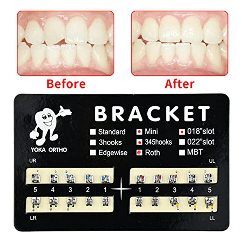 10Pack Model Metal Brackets Braces 018 Slot 345 Hooks Tooth Gem Kit Braces Tooth Braces