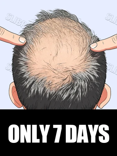 Envío gratis, aplicador de cuero cabelludo, Mini masajeador de cabeza, cepillo de bola, aplicador de líquido para el crecimiento del cabello, combinación de peine de masaje