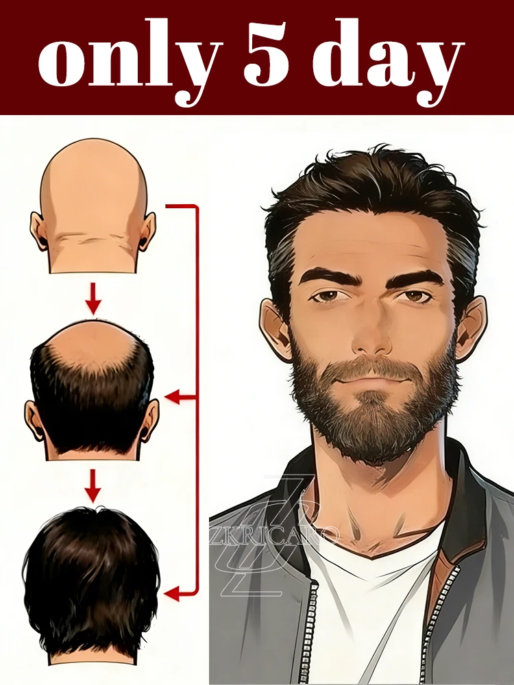 

Совершенно новое 3-е поколение: легкий спрей и вы можете опыть изменения в течение 5 дней.