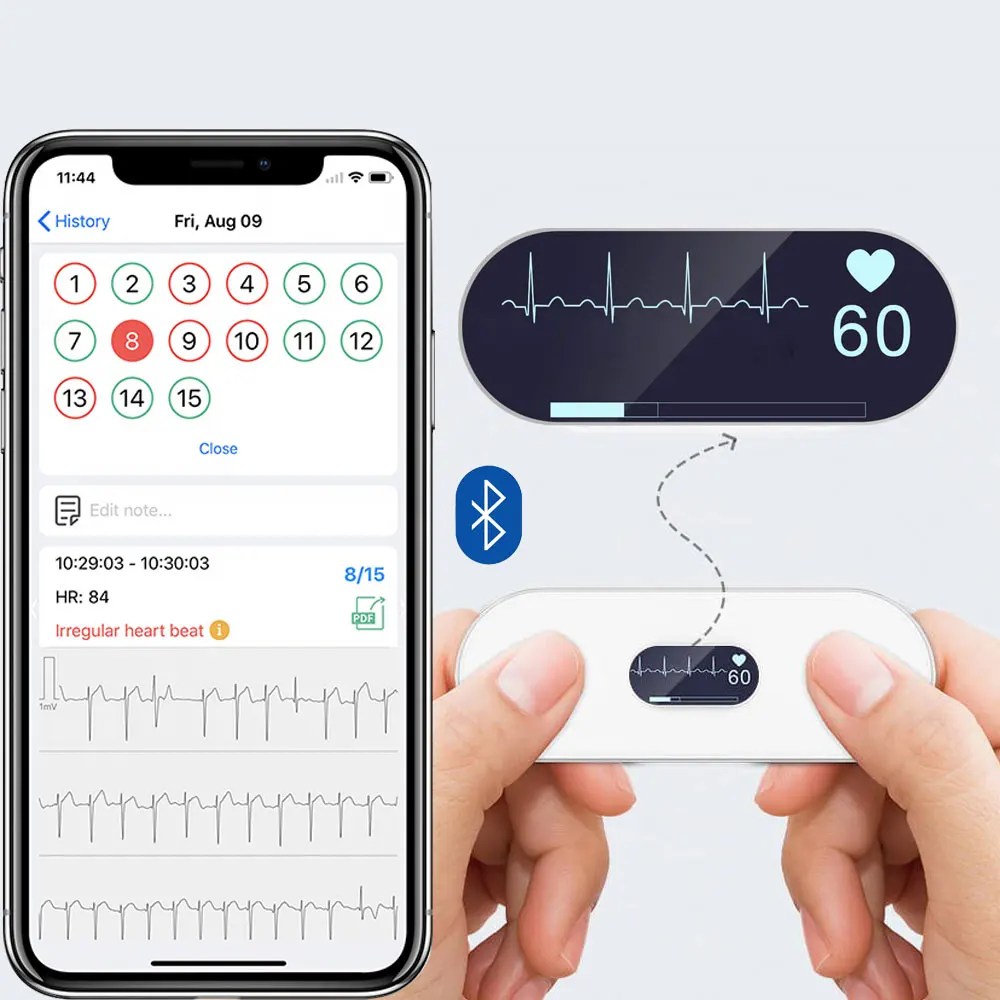 Moniteur ECG, moniteur de fréquence cardiaque pour les maladies cardiaques, les arythmies cardiaques, l'insuffisance cardiaque avec analyse IA