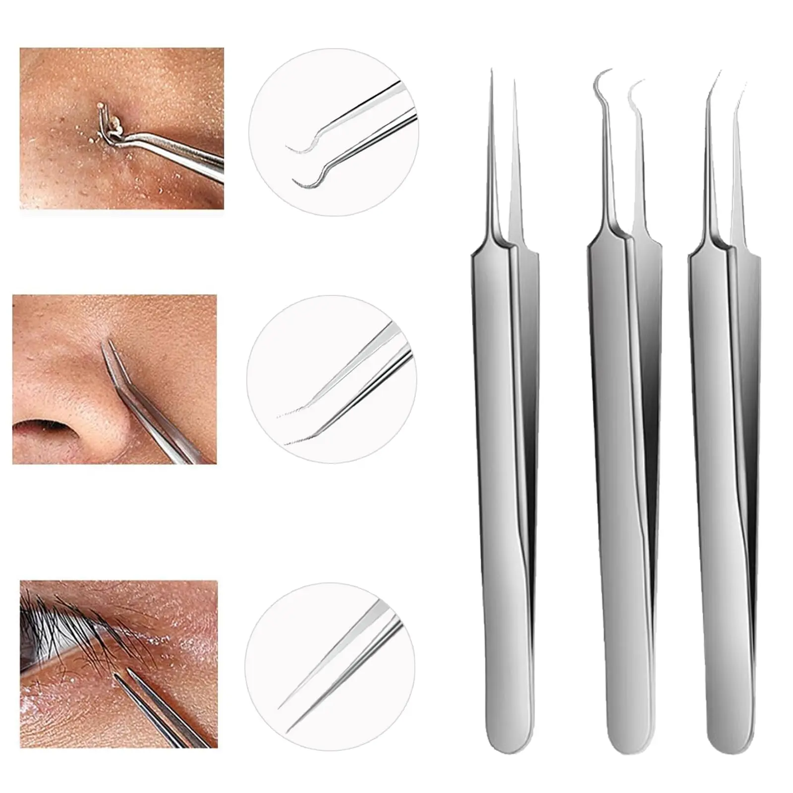 Professional Blackhead Tweezers,High Hard Stainless Steel Blackhead Remover Tweezers, Precision Pimple Popper Tool Kit, Blackhea