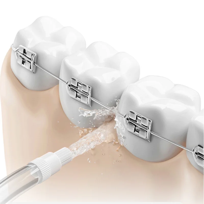 Boquillas originales para todos los irrigadores bucales Xiaomi Mijia F400, F300 y otros boquillas de repuesto para hilo dental Mijia