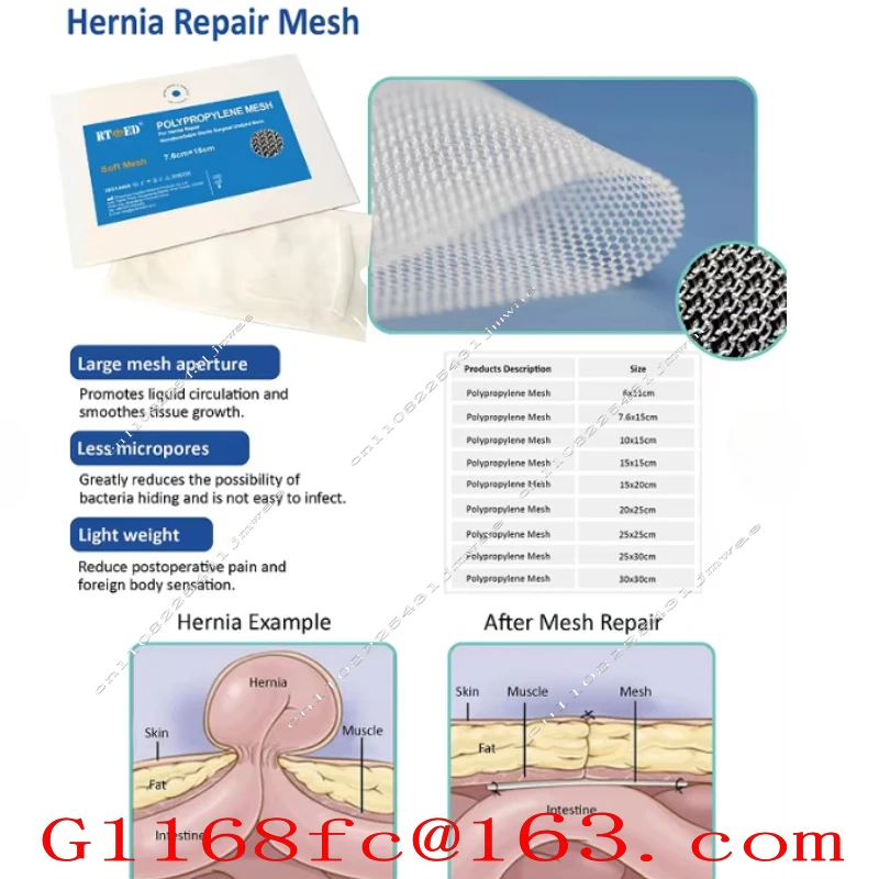 Sterile Lightweight Polypropylene Hernia Repair Mesh | Inguinal & Abdominal | 6×11cm 7.6×15cm 10×15cm 15×15cm 30×30cm