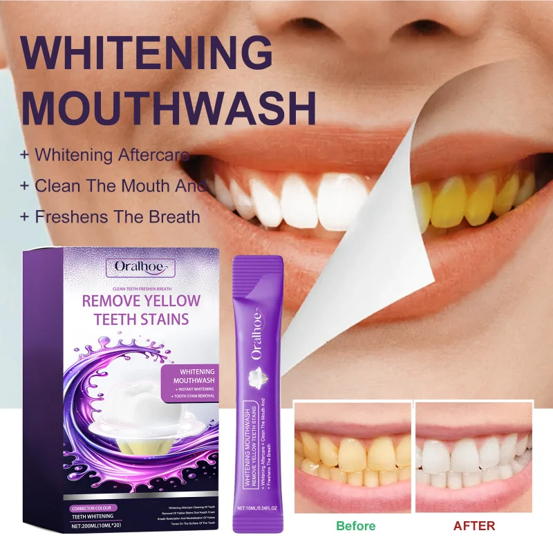 

Purple Teeth Whitening Mouthwash - Clean Yellow Teeth, Remove Stains, Freshen Breath & Oral Care For Bright Smile