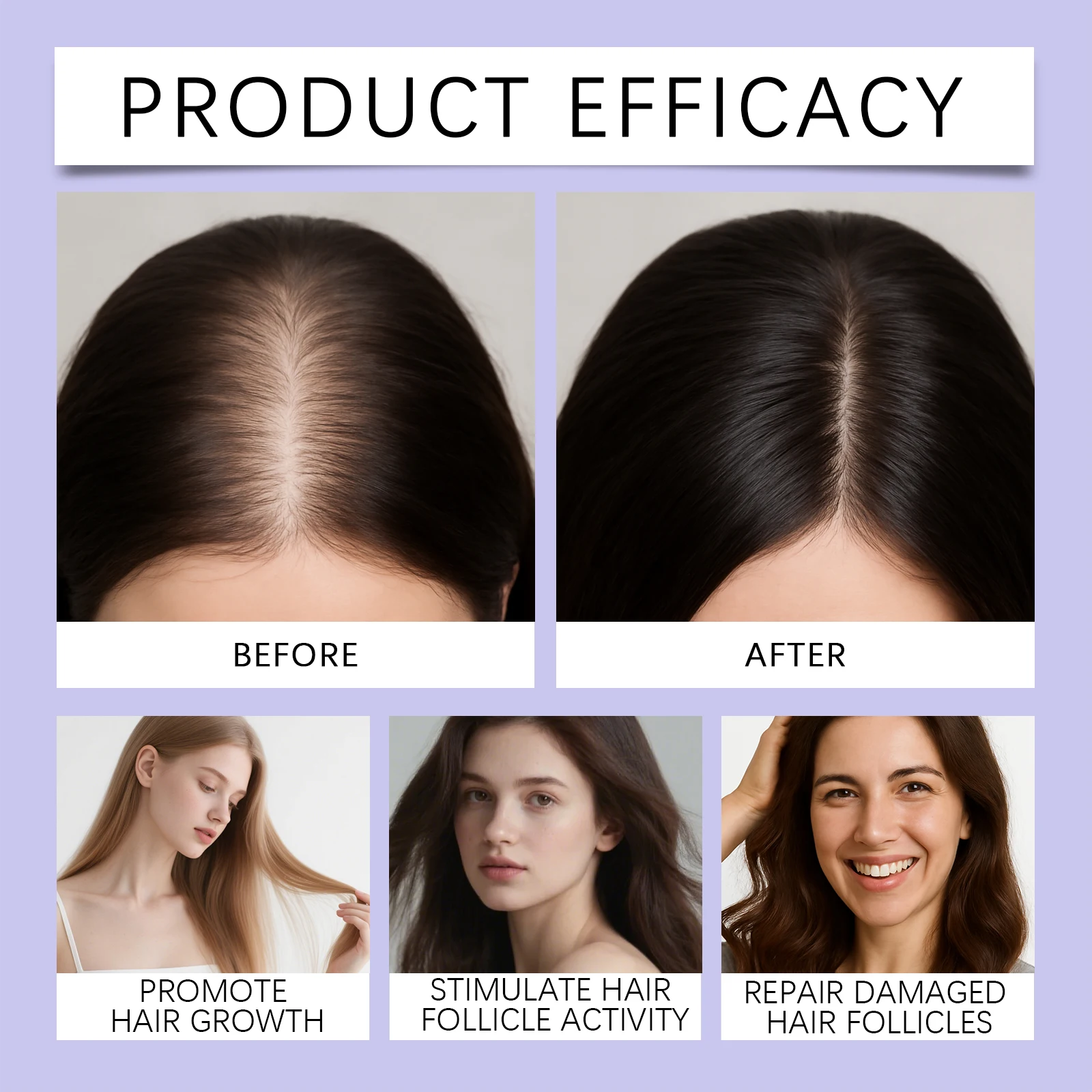 Volumizing Hair Serum Repair Damaged Hair Roots Strengthens Hair Root Relieves Scalp Fatigue Nourishes Scalp Massage Brush New