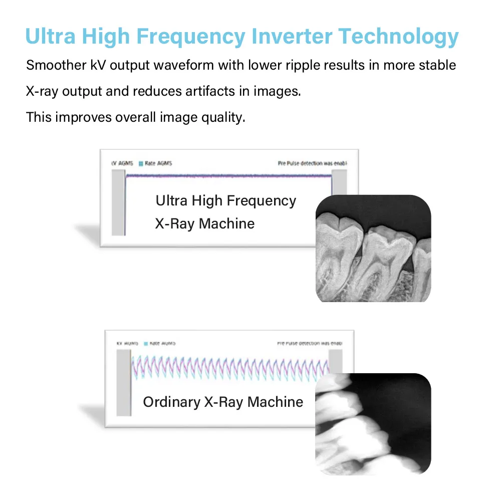 JINGT Dental X-ray Equipment Screen Image X-ray Machine Imaging System  Portable Dental X-Ray Unit Wireless High Frequency Porta