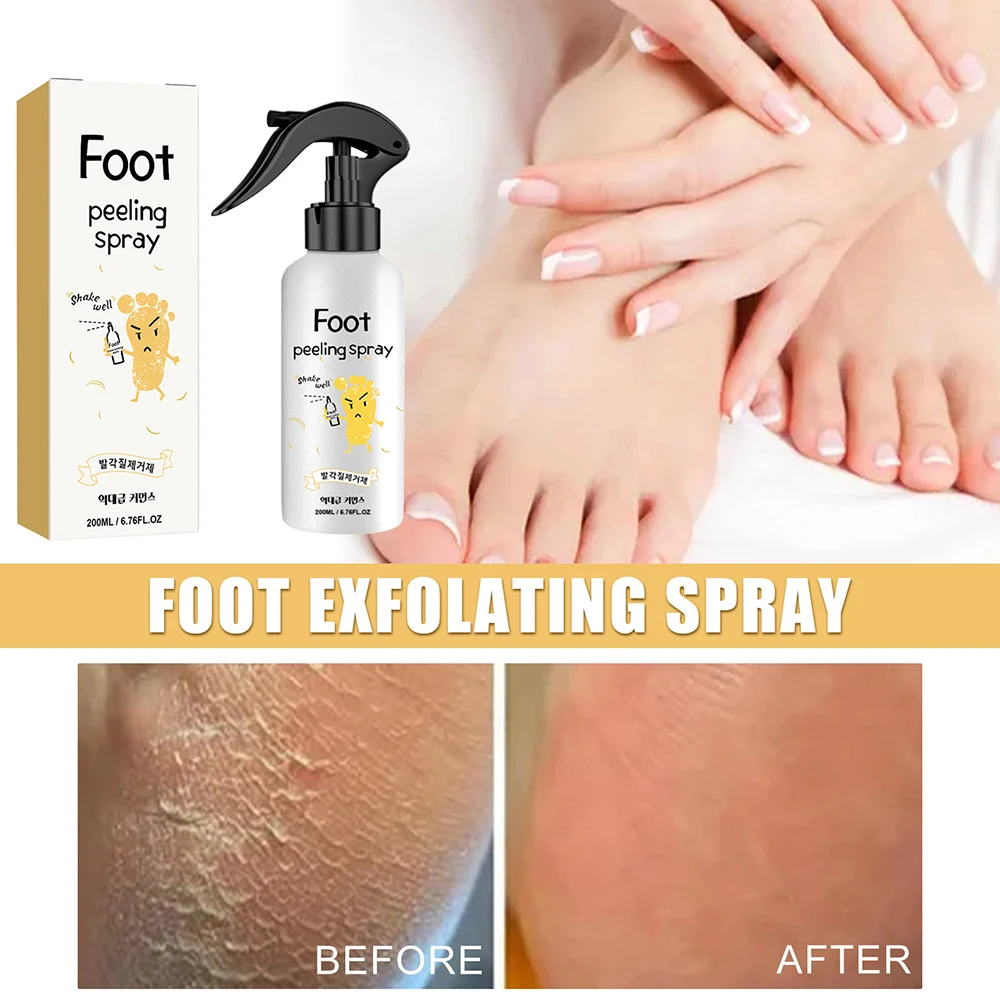 Foot Callus Remover Spray Anti Dry Cracked Beriberi Peeling Spray Natural Plant Dead Skin Removal Moisturizing and Brightening