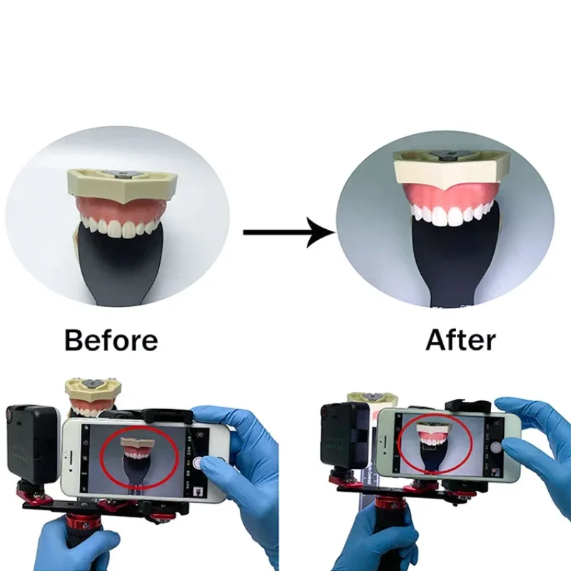 Luz de preenchimento para fotografia intraoral dentária móvel, luz colorimétrica portátil para fotografia dentária