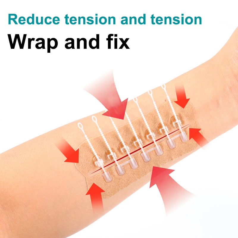 Zipper Tie Sutureless Hemostatic Wound Closure Patch Rapid  for Household Emergency Injury Care
