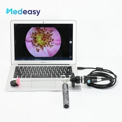 Cámara endoscópica médica portátil Full HD 1080P USB para ENT