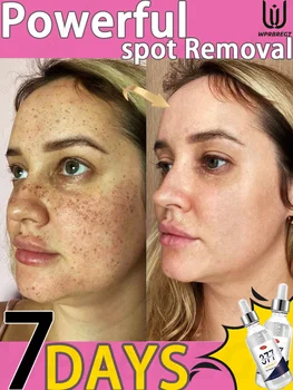 Hᴏᴛ sᴇʟʟɪɴɢ ᴘʀᴏᴅᴜᴄᴛ, 99% ᴏғ ʙᴜʏᴇʀs ʀᴇᴘᴜʀᴄʜᴀsᴇ, ʀᴇᴍᴏᴠᴇ ғᴀᴄɪᴀʟ sᴘᴏᴛs