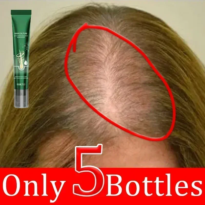 Prevent Hair Loss Repair Hair Strong Hair Growth Spray Nourishes Roots Quickly Regenerates For Men Women Growth Spray