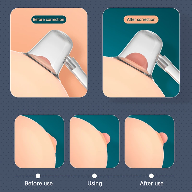 실리콘 젖꼭지 흡인기 풀러, 수축 펌프 빨판, 젖꼭지 마사지기 교정기, 휴대용 여성 젖꼭지 교정, 엄마 건강 관리