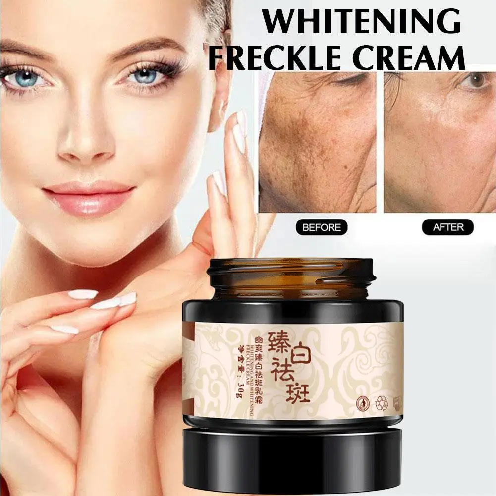 

30g Powerful Whitening Freckle Cream Plant Face Cream Cream Freckle N1S2 Freckles Dark Face Remove Plant Whiteni Spots Crea D2G5