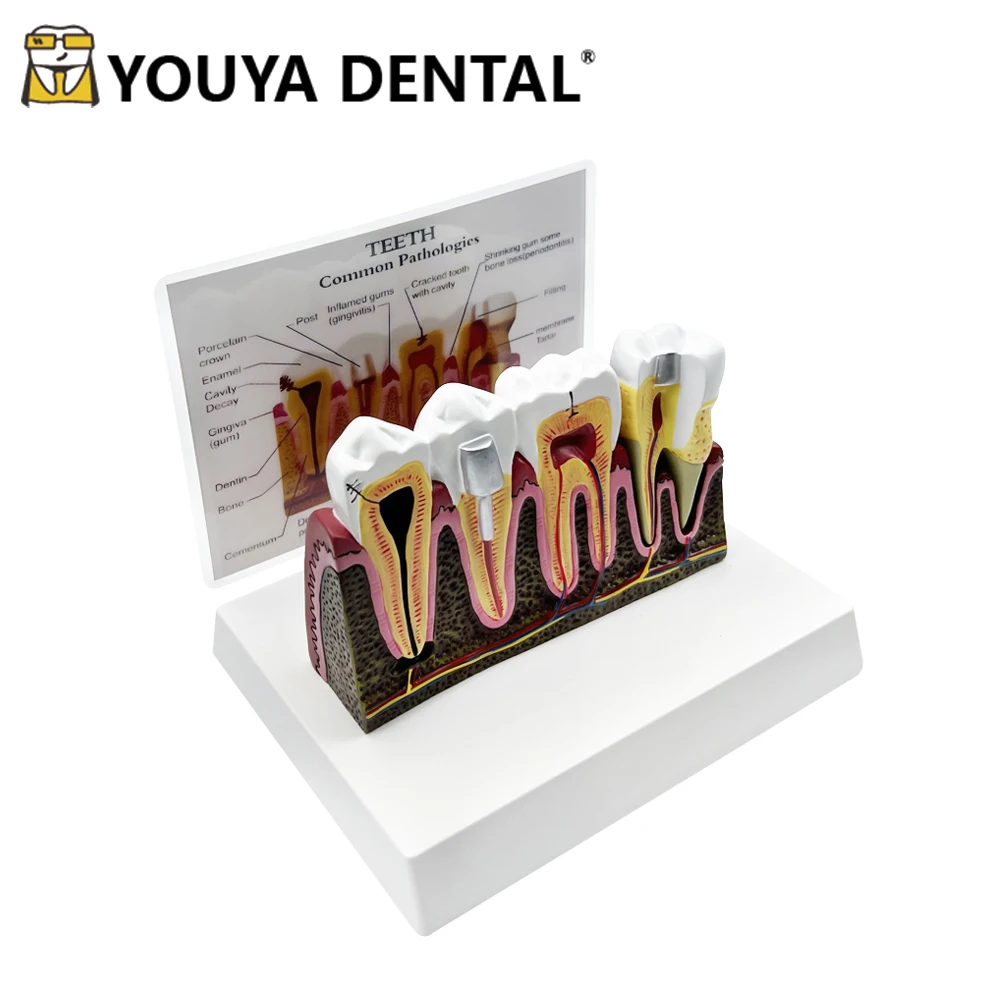 Tooth Structure Anatomical Standard Model Comprehensive Model Dental Technician Student Studying Teaching Practice Demonstration