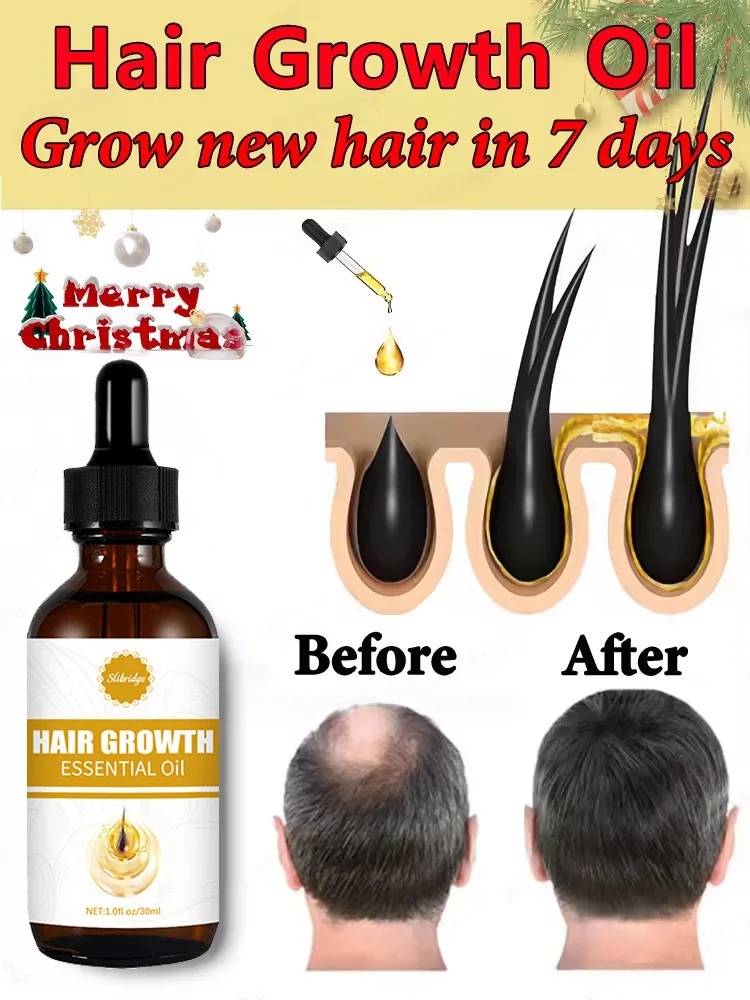 Hot sale, buyers will buy again, hair is getting more and more, say goodbye to baldness, sparse hair starts to become thick