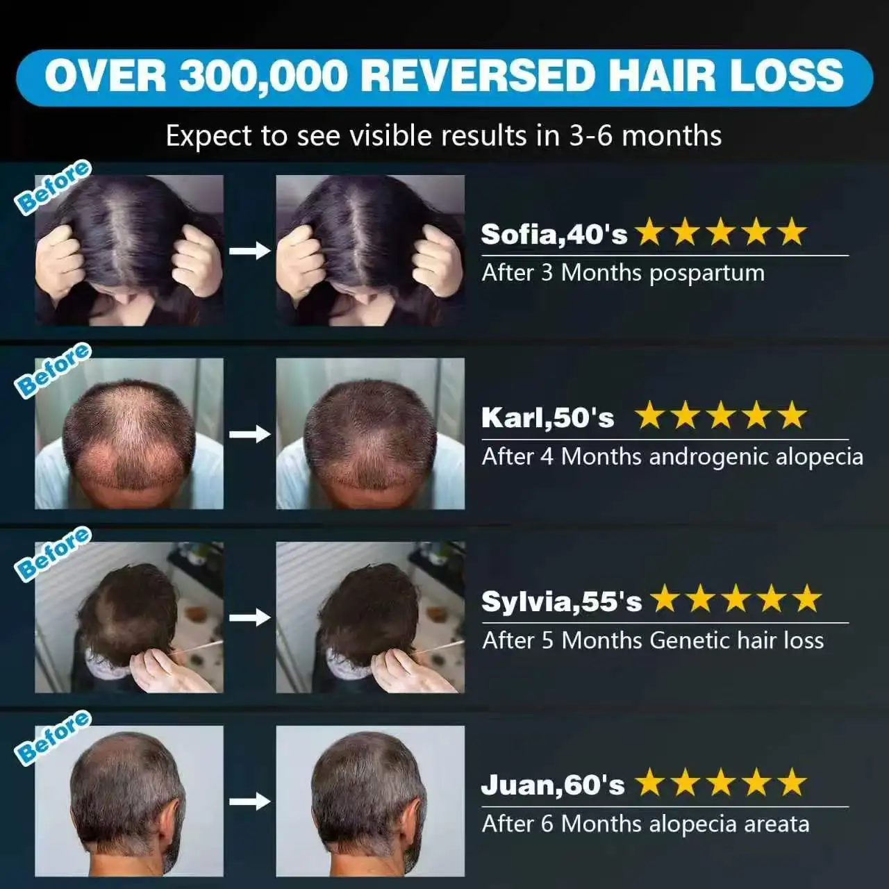 Professional Laser Hair Loss Treatment Helmet Advanced Regrowth Cap for Men Women Scalp Care