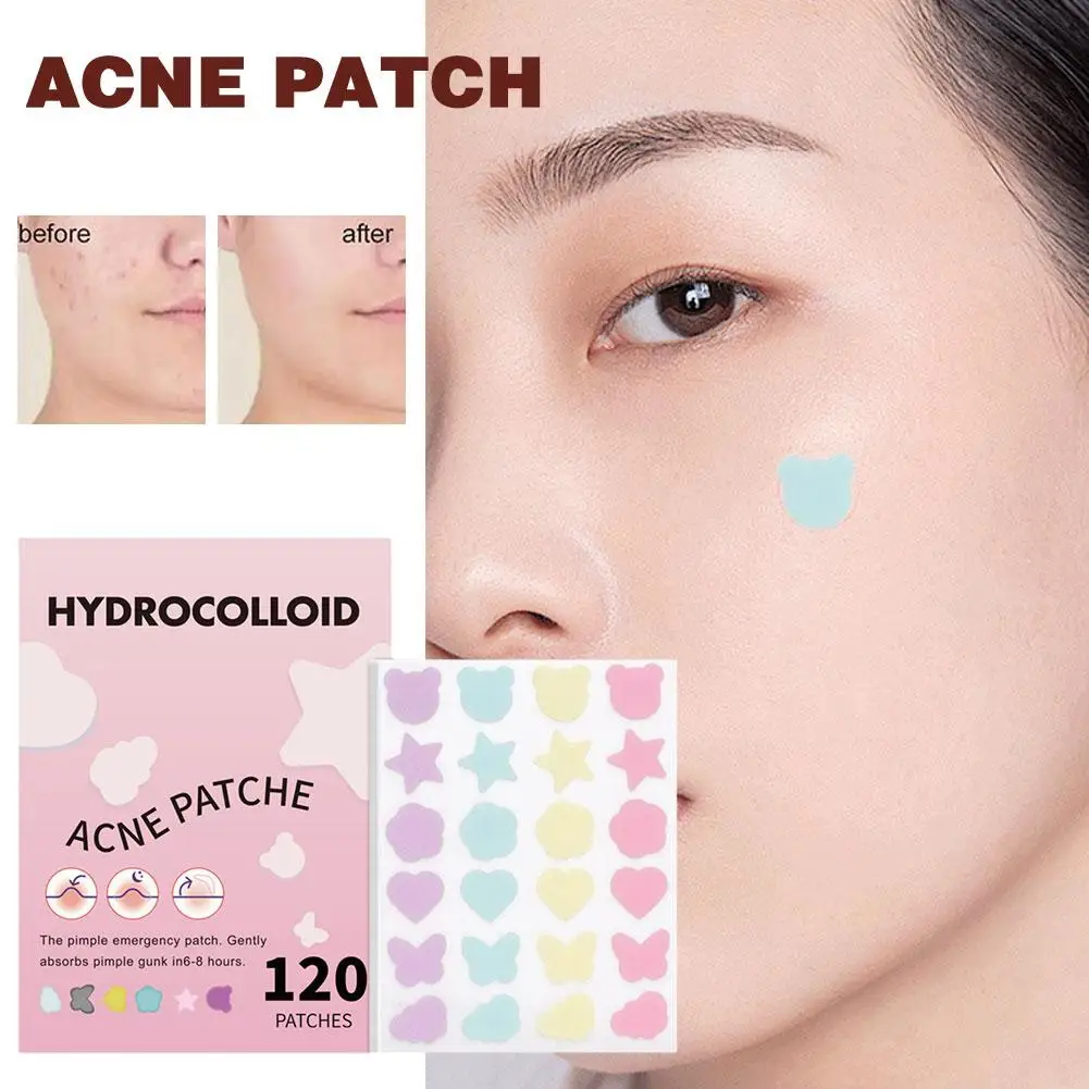 New Acne Pimple Patch Stickers Acne Treatment Pimple Skin Blemish Remover SHEETS 5 Facial Waterproof Care Mask Tool Spot H7A6