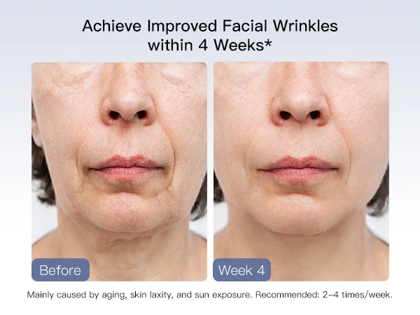 Face lift massage