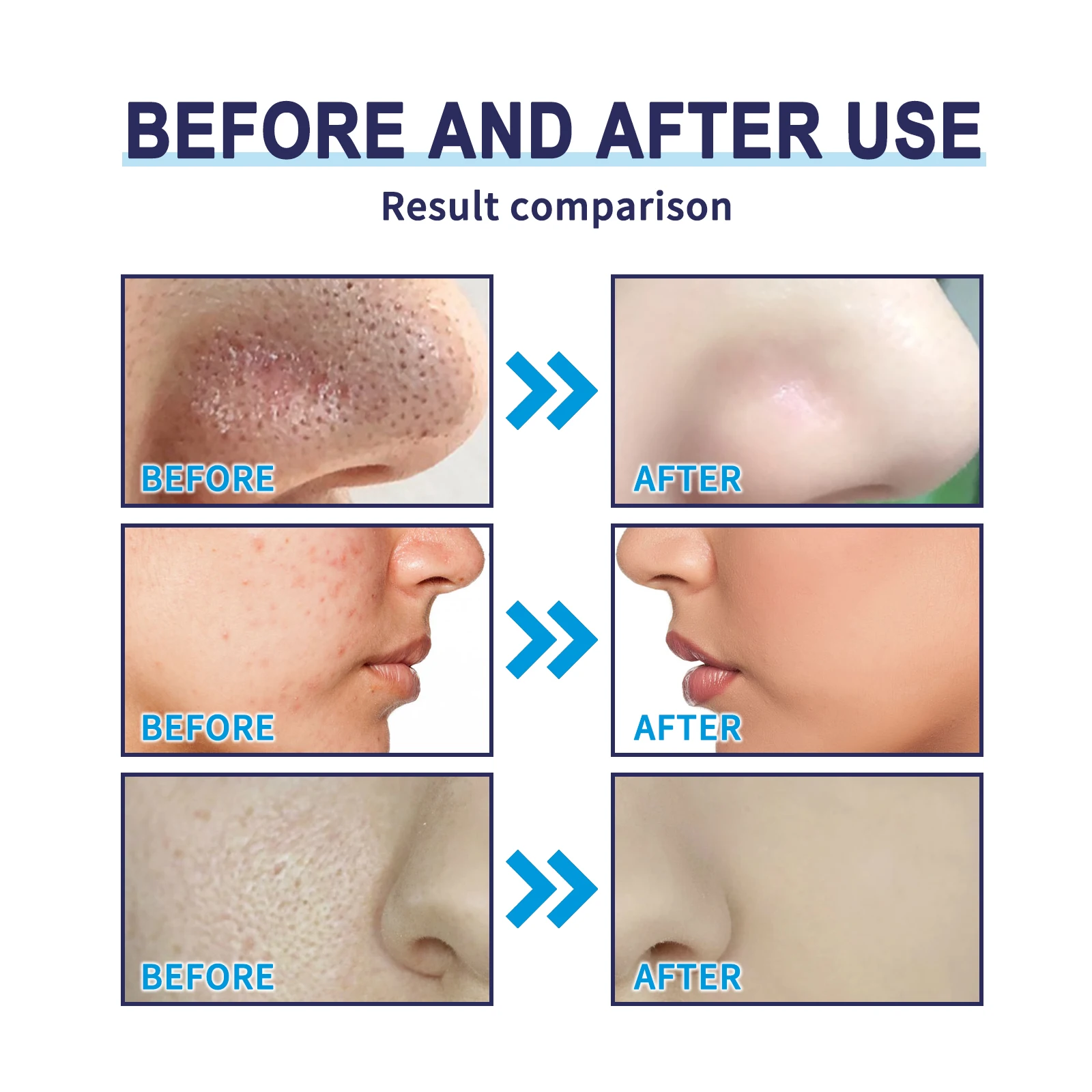 Sapphire Charcoal Blackhead Remover Peel Off Set,Dual Oil Absorption&Remove Strawberry Nose,Soothing&Anti Sensitive,Shrink Pores&Smooth Skin Texture,Satisfying Peel Off Mechanism,2-in-1 Cleansing&Repairing,Skin Safe Glitter,Clean Beauty