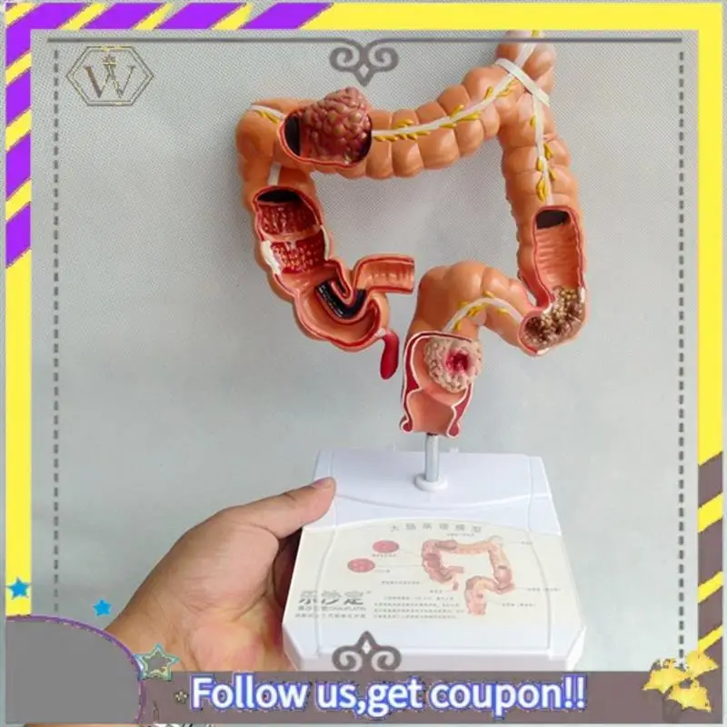 New Teaching Model,Human Large Intestine Anatomy Model Visceral Lesion Model Human Digestive System Learning Model Easy Install