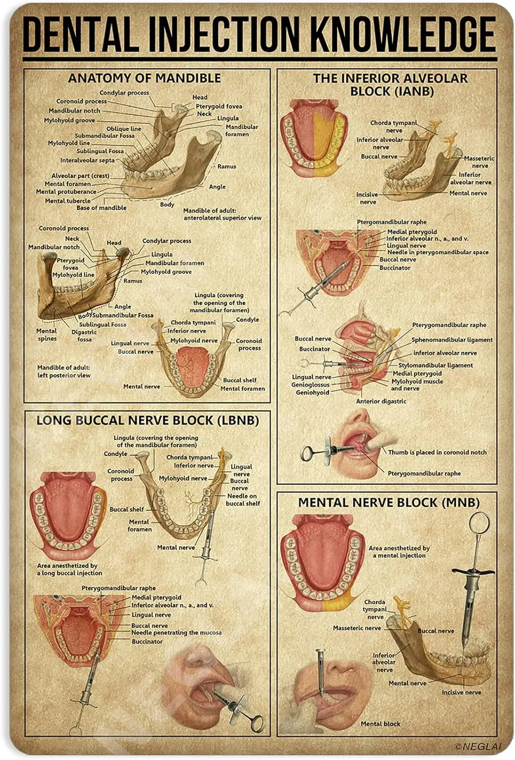 Dental Injection Knowledge Metal Signs Poster, Vintage Wall Decor Farmhouse Decorations 16x12 Inches